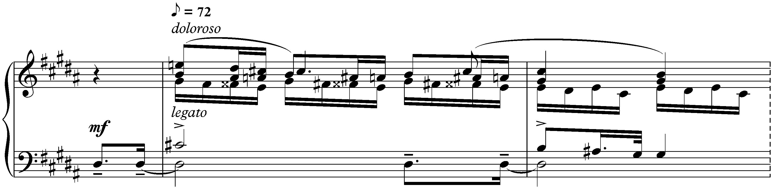 Sonata no. 3 in F-sharp minor, op. 23; 3. Andante