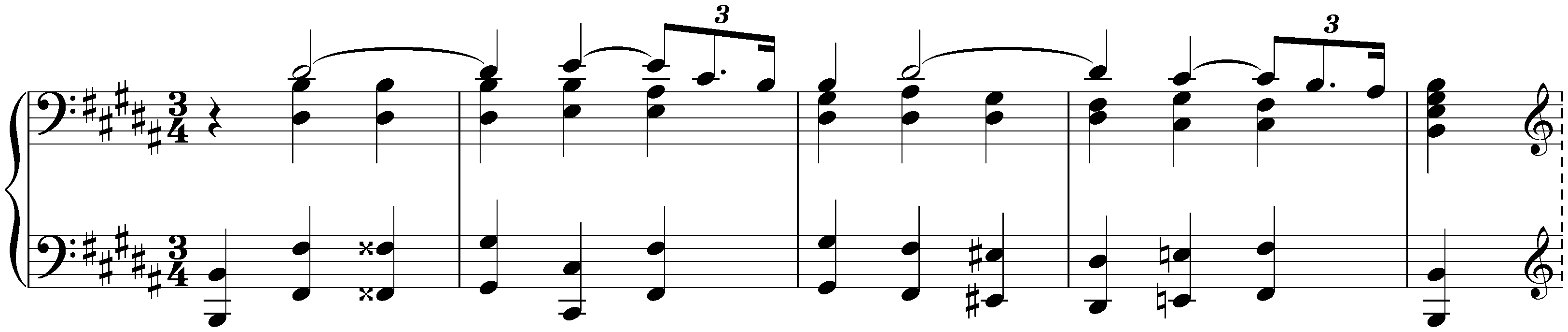 Sonata in E-flat minor, WoO 19; 2.