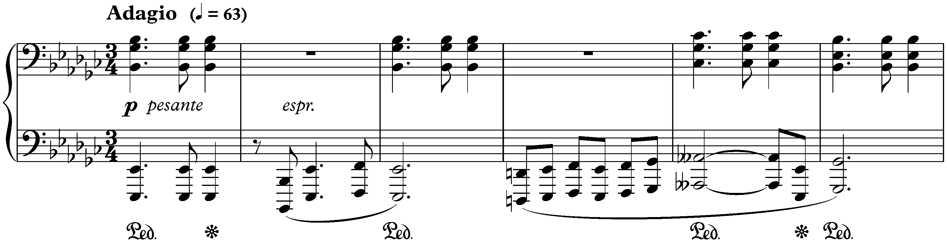 Twenty-four Preludes, op. 34; 14. E-flat minor