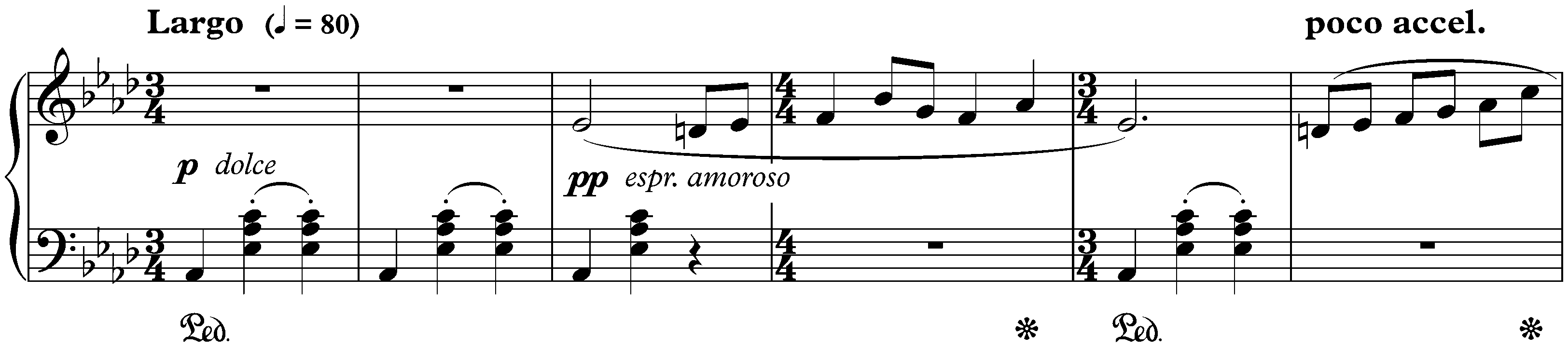 Twenty-four Preludes, op. 34; 17. A-flat major