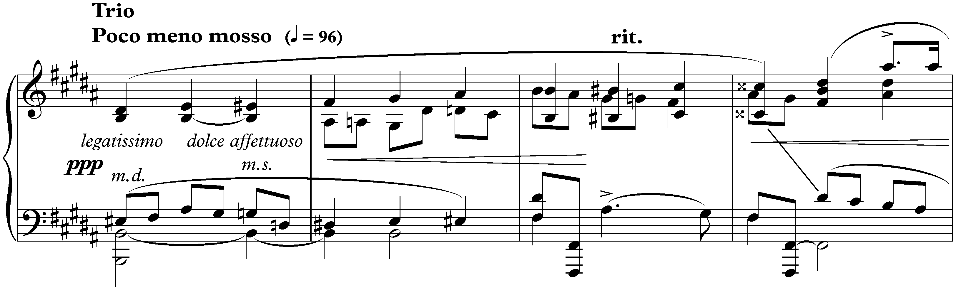 Sonata no. 1 in C minor, op. 8; 3. Tempo di minuetto. Comodo